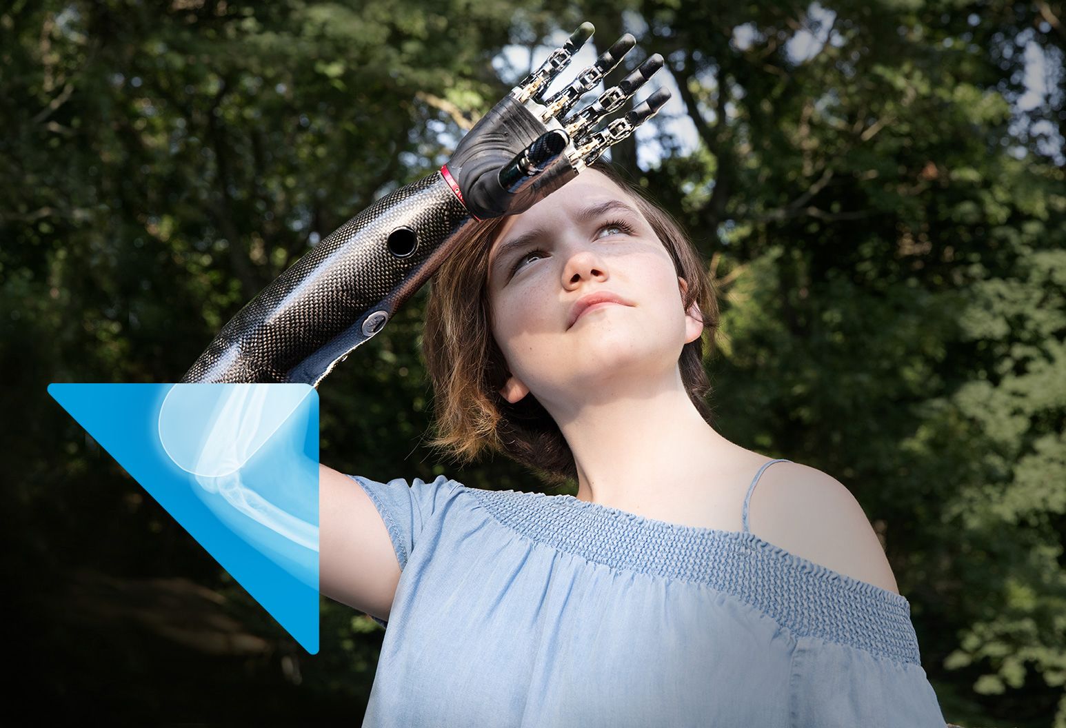 A girl with a prosthetic arm raised above her forehead standing with a background of trees